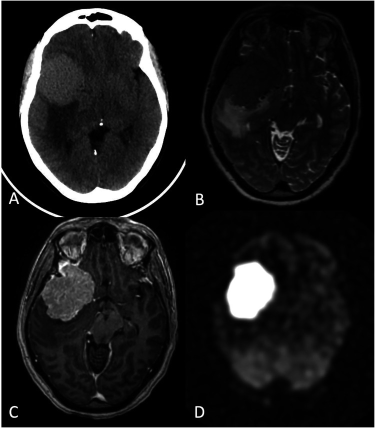 Figure 10.