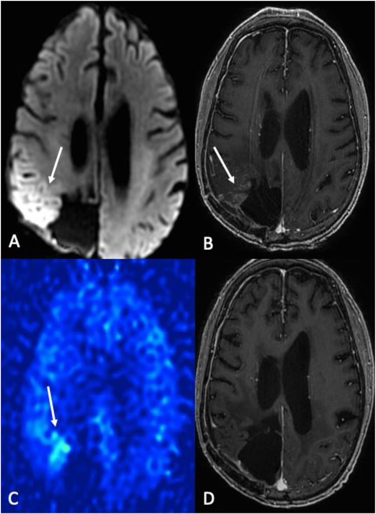 Figure 13.