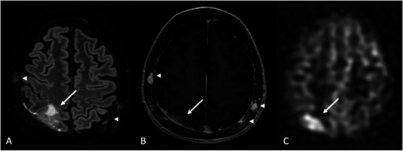 Figure 11.