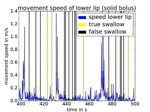 Fig 4.