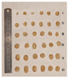 Figure 21