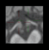 Fig.1