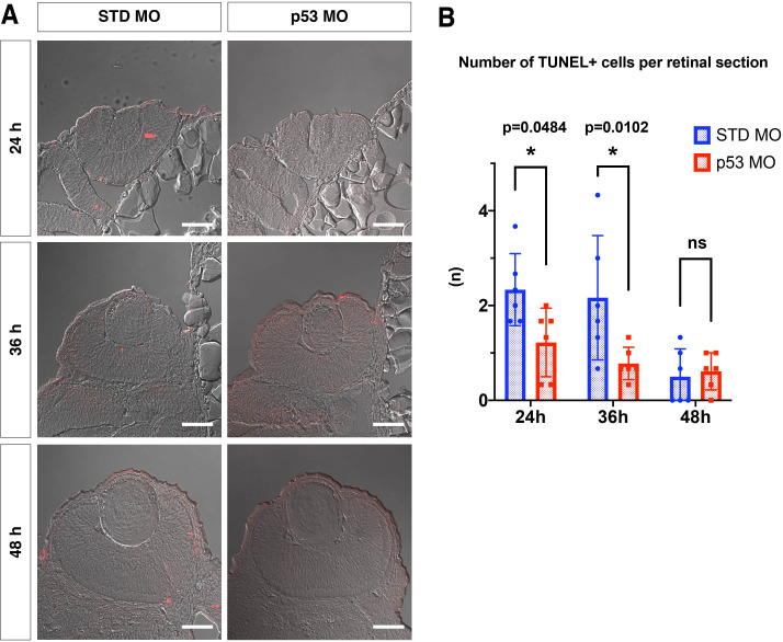 Figure 3—figure supplement 2.