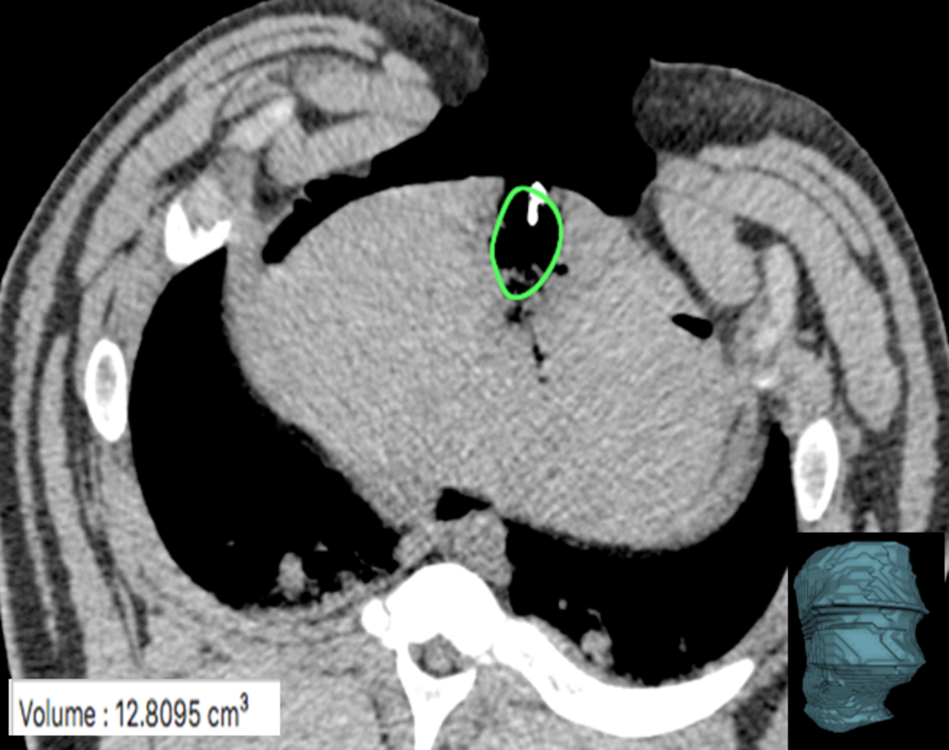 Figure 4: