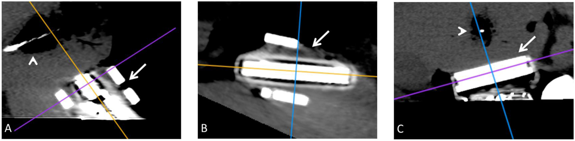 Figure 2: