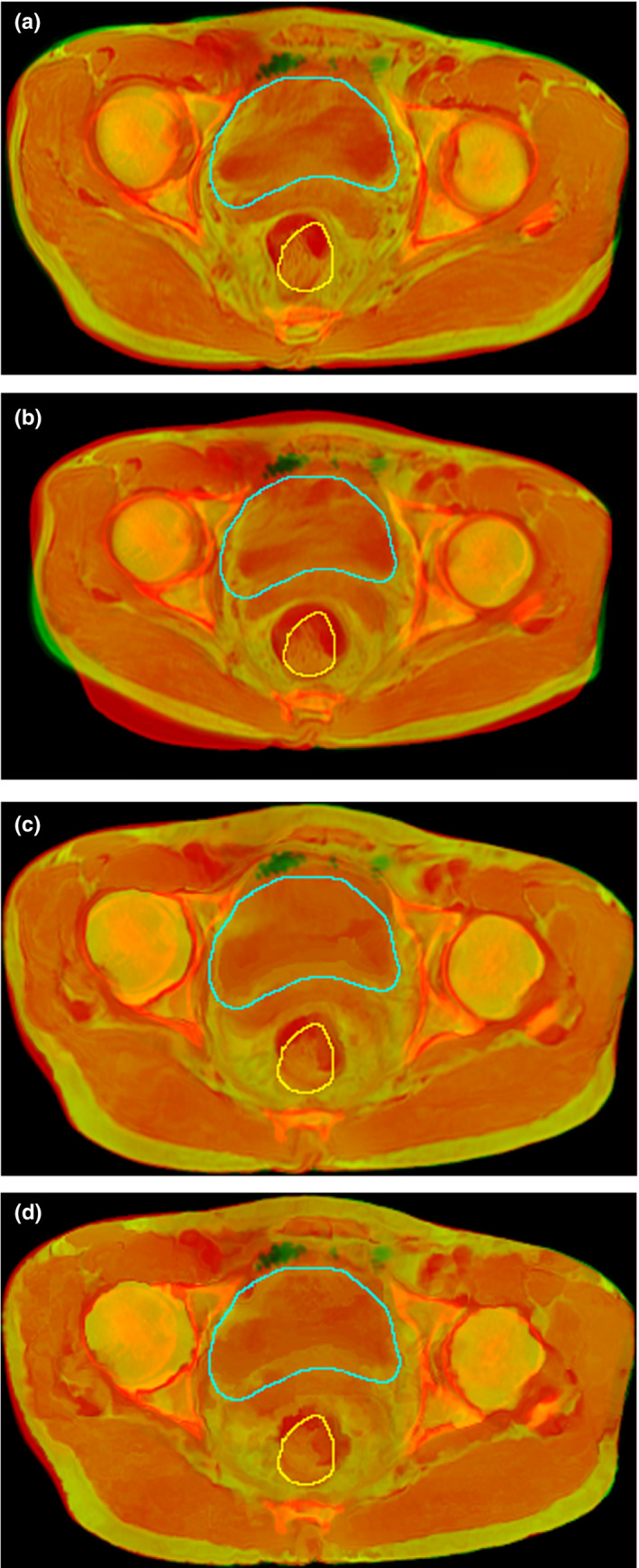Fig. 4