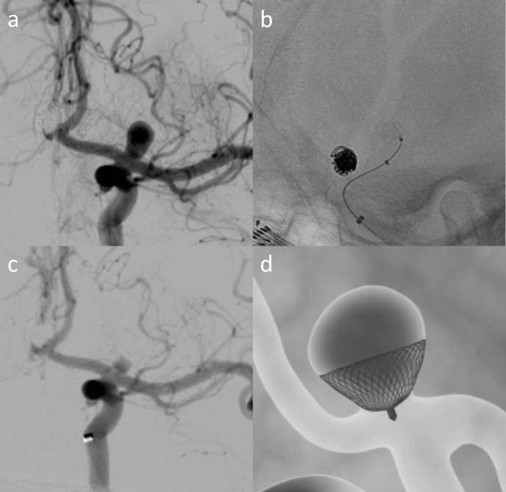 Figure 13.