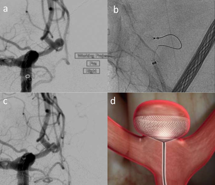 Figure 12.