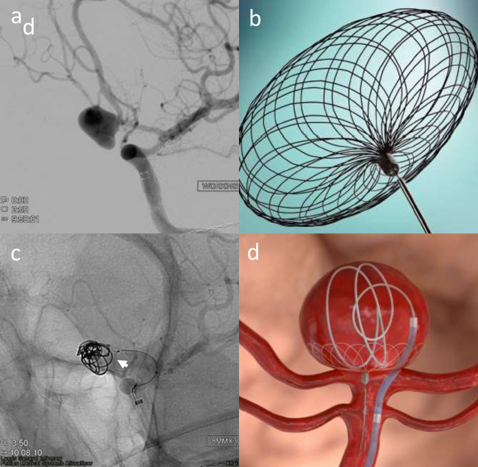 Figure 14.