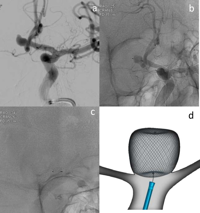 Figure 10.