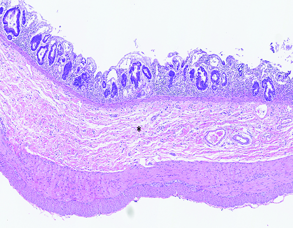 Figure 1e.