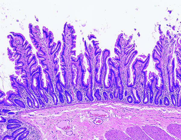 Figure 2e.