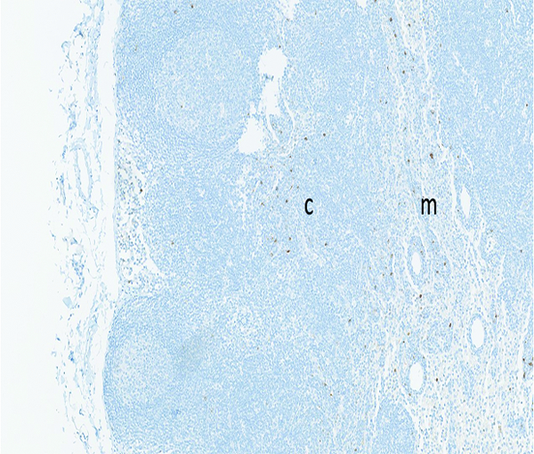 Figure 13a.