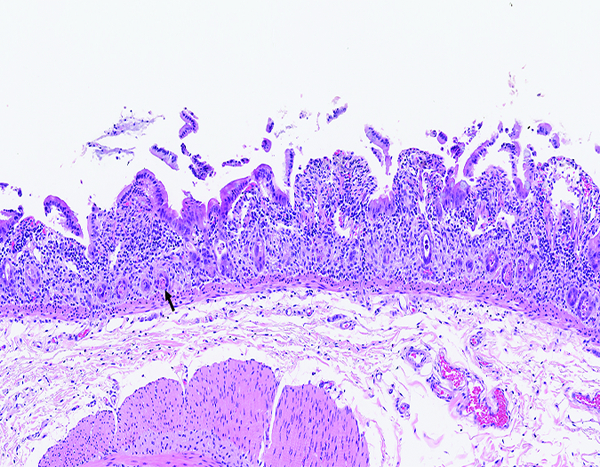 Figure 1c.