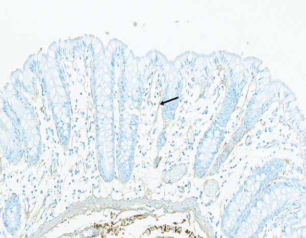 Figure 10b.