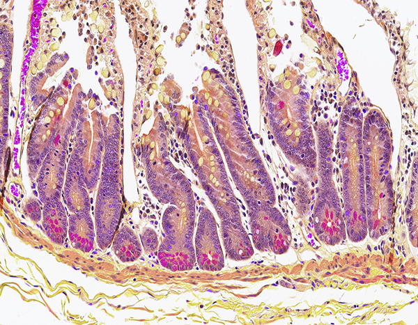 Figure 5d.