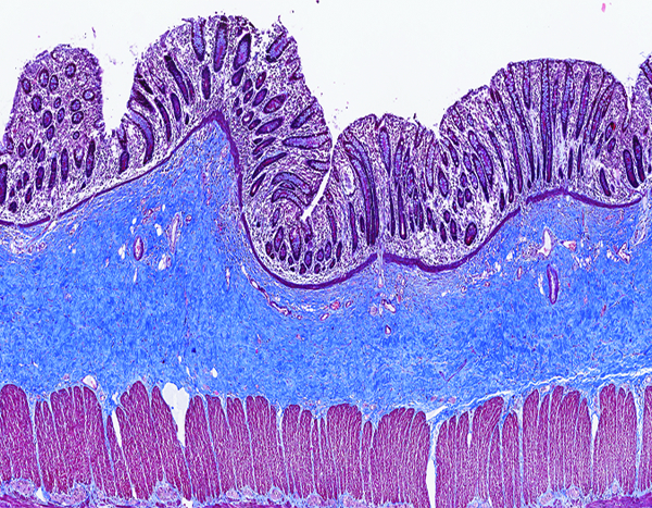 Figure 9b.