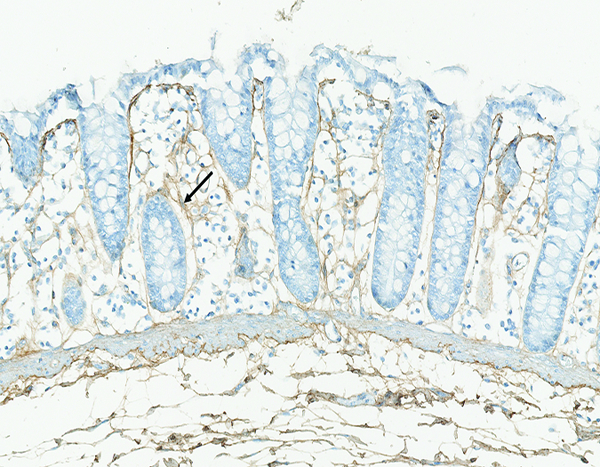 Figure 10c.