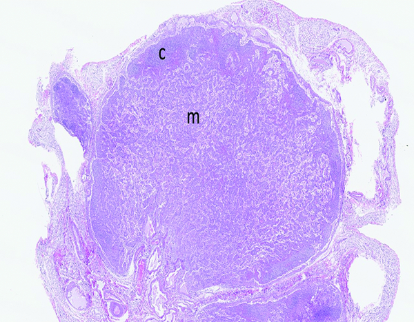 Figure 11c.