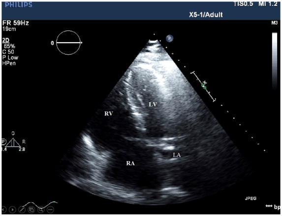 Figure 4