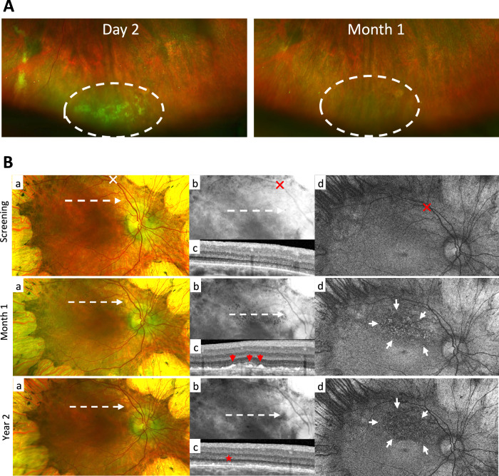 Fig. 2