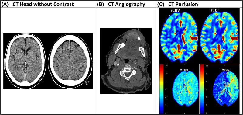 FIGURE 2