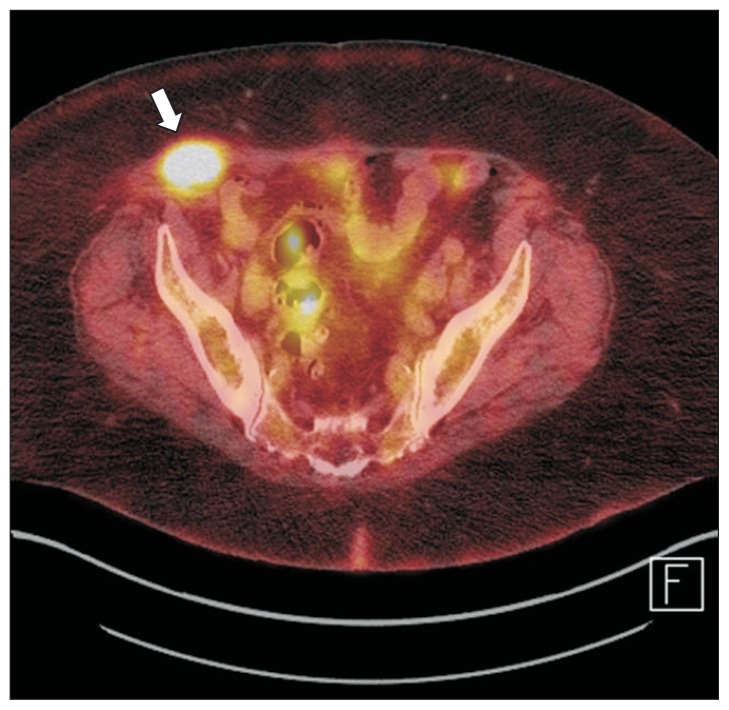 Fig. 6