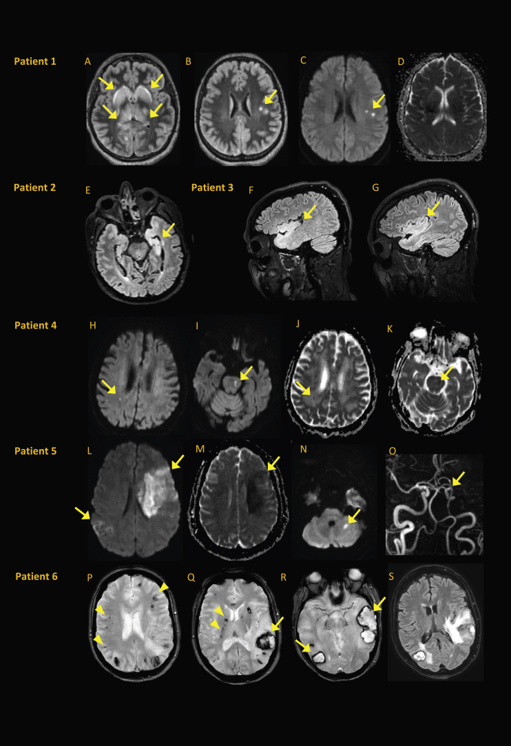 Fig. 2