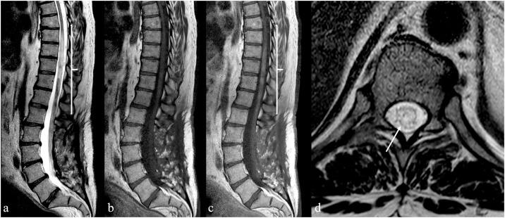 Fig. 11