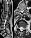 Fig. 13