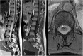 Fig. 15