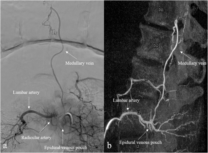 Fig. 12