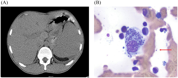 FIGURE 1