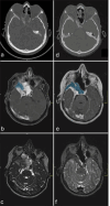 Figure 2: