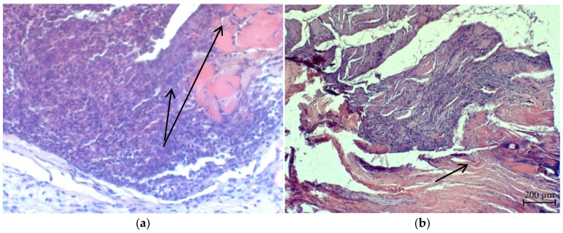 Figure 22