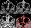 Fig. 9
