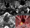 Fig. 8