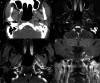 Fig. 10