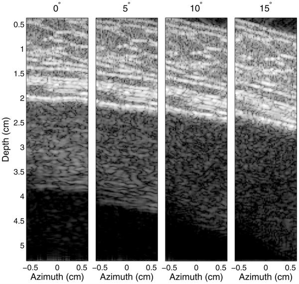 Fig. 12