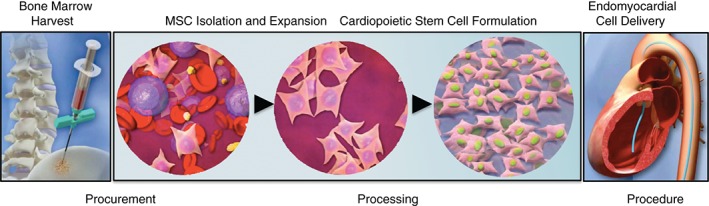 EJHF-434-FIG-0002-c