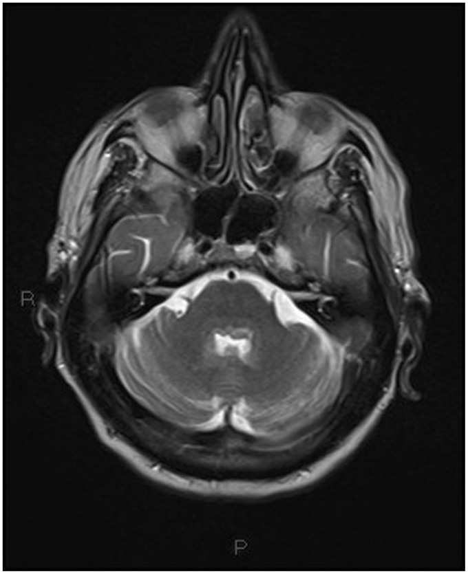 Figure 11.