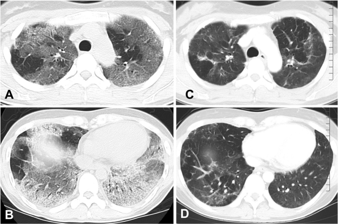 Fig. 2