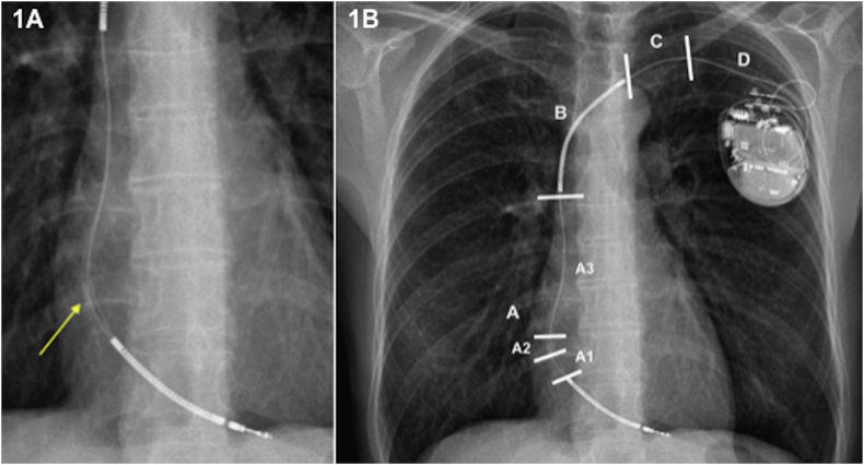 Fig. 1