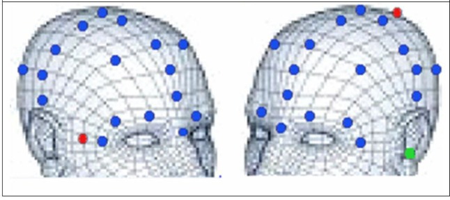 Fig. 2