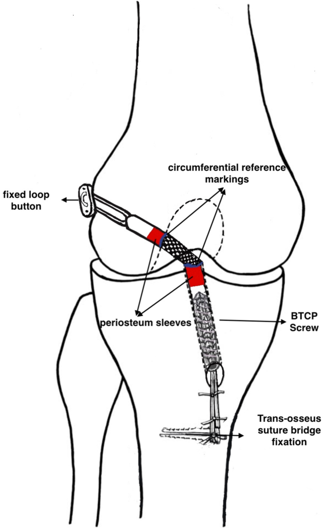 Fig 11