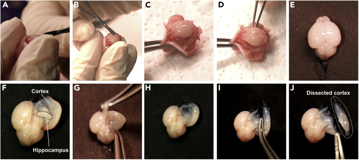 Figure 4