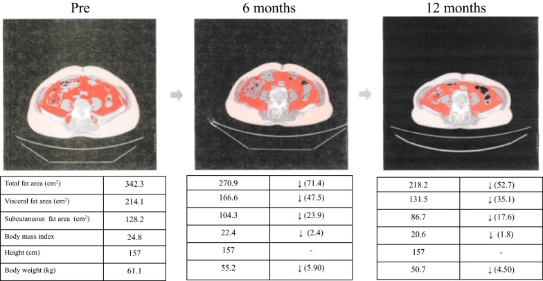 Fig. 1