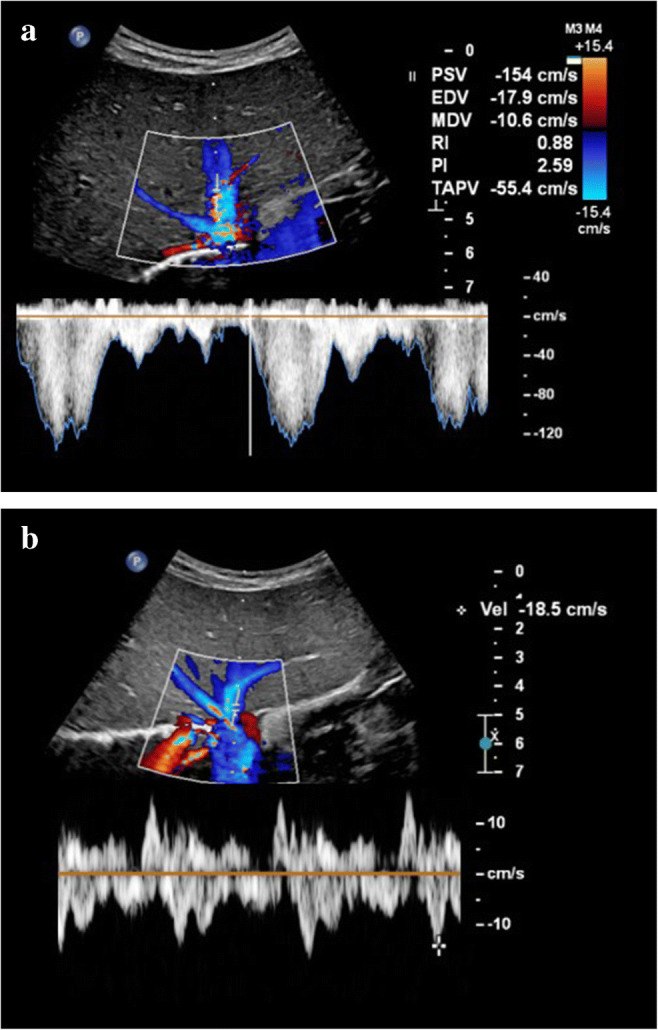 Fig. 4