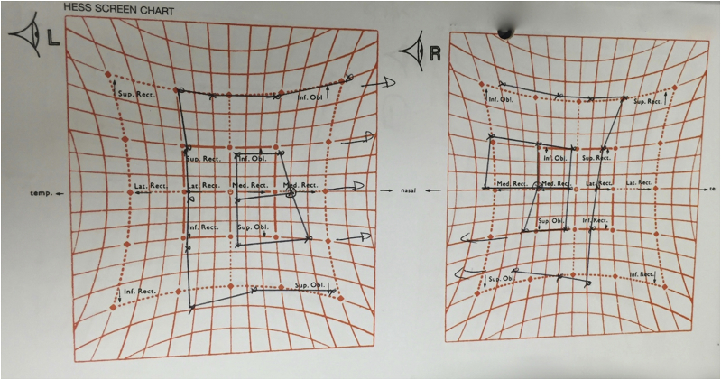 Fig. 2