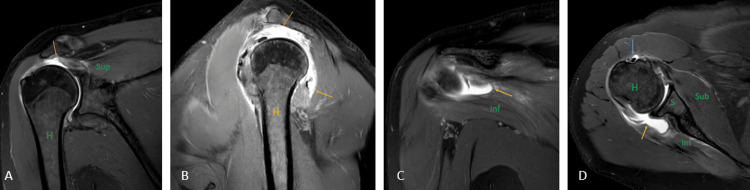 Figure 17